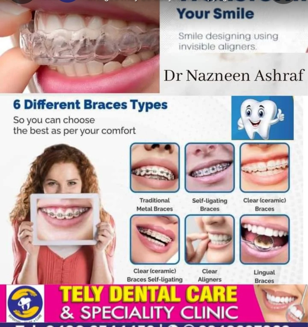 Dental clinic thalassery,Dental doctor thalassery, Tely dental care thalassery 
