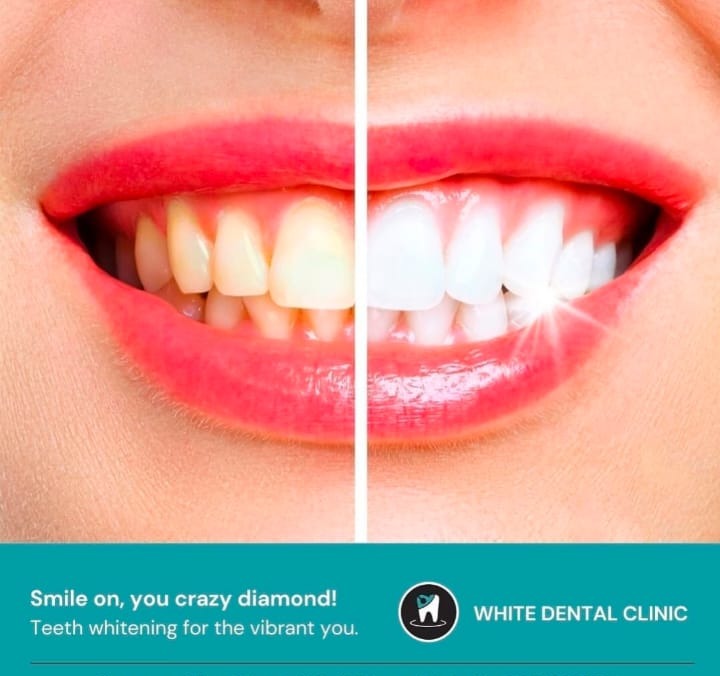 Dental Clinic Kuttiadi,Dental Care Kuttiadi,Dr. Wyte Dental Centre 