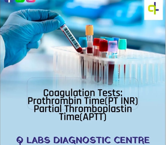 Lab Pang Chendi Malappuram, Diagnostic Centre  Pang Chendi Malappuram,Q Labs Diagnostic Centre 