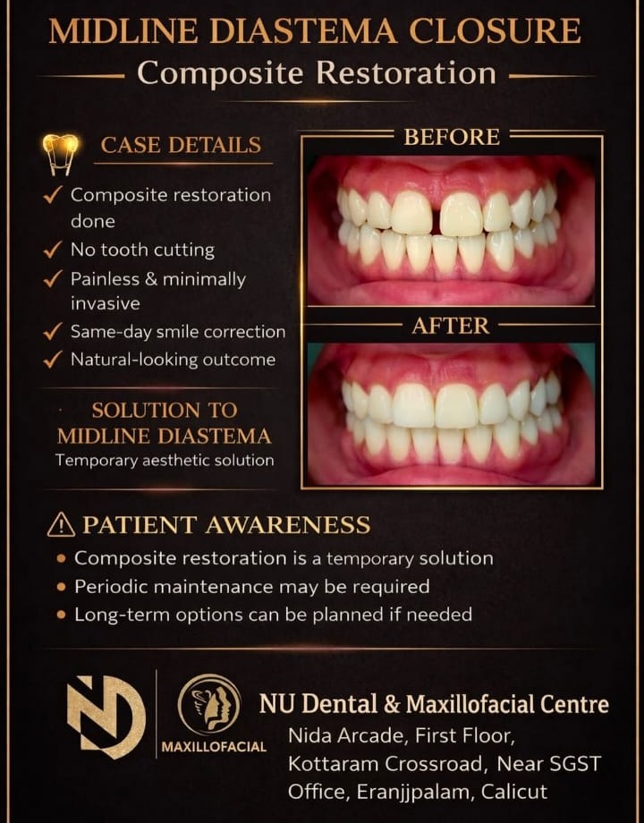 Dental Clinic Eranjipalam Calicut, Maxillofacial Centre Eranjipalam Calicut,Nu Dental & Maxillofacial Centre 