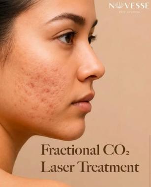 Skin clinic pattom trivandrum,Skin Hair Wellness treatment in pattom trivandrum,Novesse Skin Science Clinic 
