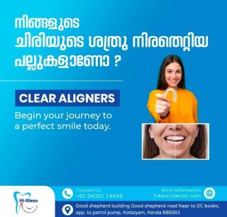 Dental Clinic in kottayam,Rootcanal centre in kottayam,Clear aligner centre in kottayam,Hi-Klean Multispeciality Dental Clinic 