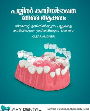Dental Clinic in thiruvilwamala mayannur,Pediatric dental care in thiruvilwamala mayannur,AVY Dental Clinic 