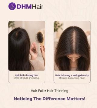 Hair clinic in calicut,Hair restoration in calicut, DHM Hair Clinic