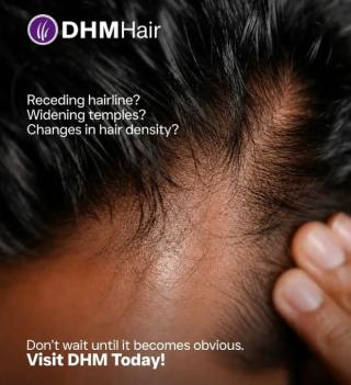 Hair clinic in calicut,Hair restoration in calicut, DHM Hair Clinic