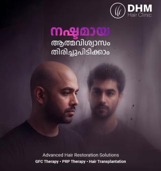 Hair clinic in calicut,Hair restoration in calicut, DHM Hair Clinic
