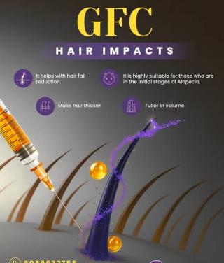 Hair clinic in calicut,Hair restoration in calicut, DHM Hair Clinic