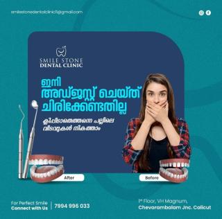 Multispeciality dental clinic in calicut, Aligners Dental Implants Dental care in calicut,Dentist in calicut,Smile Stone Dental Clinic 